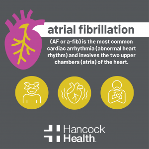 Atrial Fibrillation Symptoms and Treatment